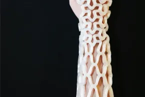 Castomize – TessaCast